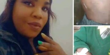 Brutalised child reveals it all before court, says stepmom used knife to hurt him